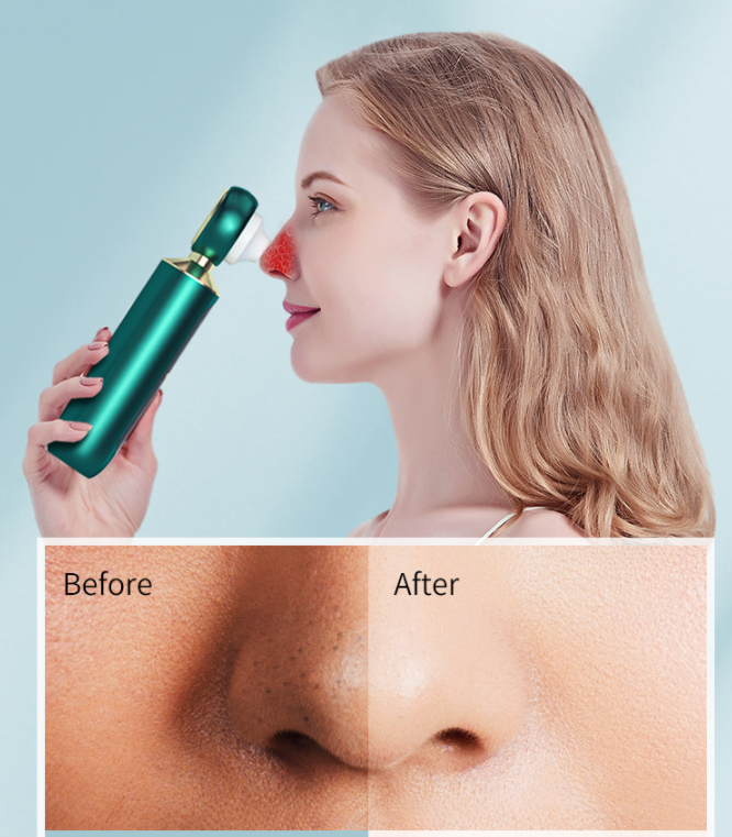 Visual Blackhead Meter